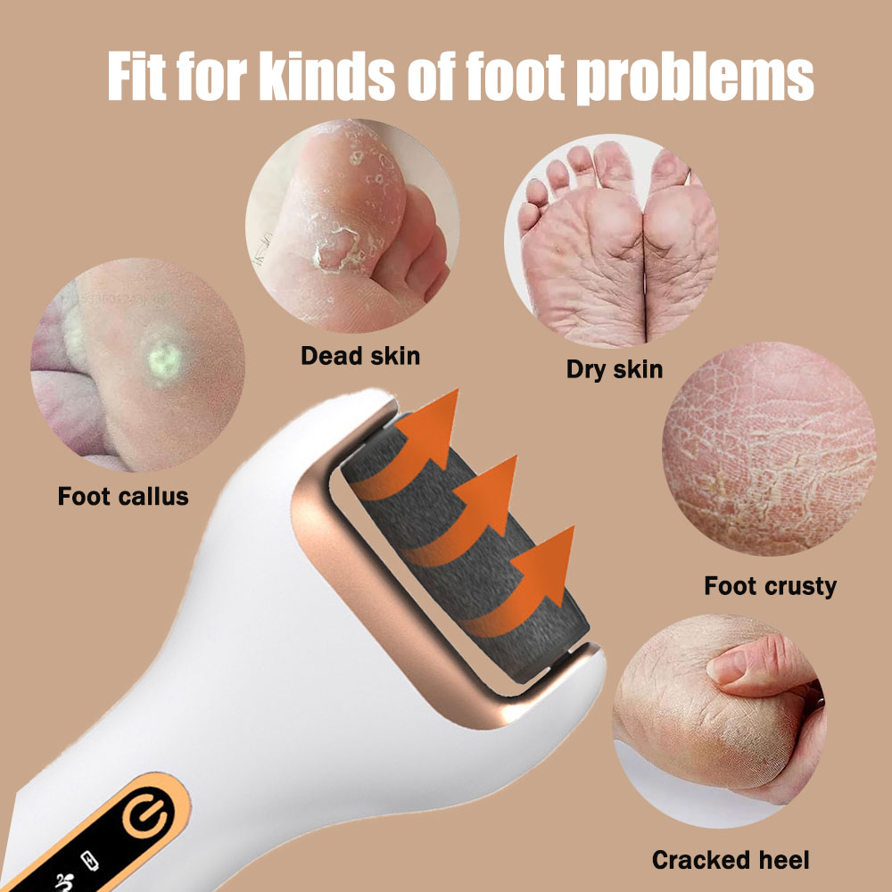 Rechargeable Electric Foot Ras - Woodworking Rasp 评论和价格